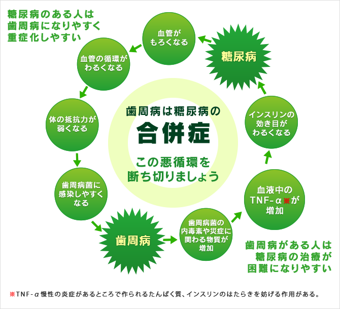 歯周病は糖尿病の合併症 この悪循環を断ち切りましょう